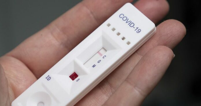 TCDF apura supostas irregularidades em fornecimento de 100 mil testes de Covid-19 ao Governo do DF